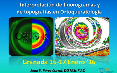 Curso Avanzado de Ortoqueratología – COOOA Granada 16-17 Enero’16