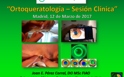 Sesión Clínica Ortoqueratología FEDERÓPTICOS – Madrid, 12 Marzo’17