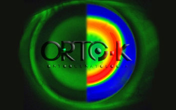 Recomendando Orto-k en niños para frenar su miopía. Respaldo científico.
